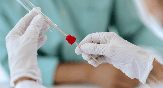 Detección de VPH por PCR en CDMX